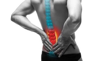 Η οστεοχόνδρωση είναι μια ασθένεια της σπονδυλικής στήλης